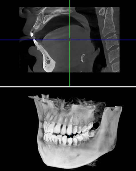 3D Radyolojik Görüntüleme 1